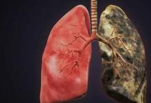 癌癥AI與多學(xué)科腫瘤委員會達(dá)成92%的最高協(xié)議