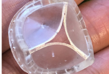 新的心臟瓣膜可改變?nèi)驍?shù)百萬患者的心臟直視手術(shù)