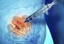 全球主要研究揭示了乳腺癌擴(kuò)散到身體其他部位的風(fēng)險(xiǎn)