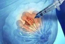 三分之二的晚期乳腺癌患者的平均生存時(shí)間翻了一番