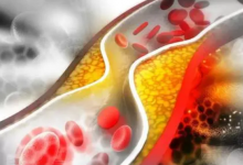 口服 PCSK9 抑制劑可安全 有效地降低膽固醇