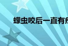 蠓蟲咬后一直有疙瘩（蠓蟲怎么驅趕）