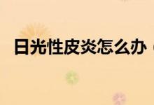 日光性皮炎怎么辦（有這樣兩種治療方法）
