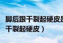 腳后跟干裂起硬皮是什么原因（為什么腳后跟干裂起硬皮）