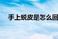 手上蛻皮是怎么回事（為什么手上蛻皮）