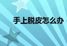手上脫皮怎么辦（把握以下治療方法）