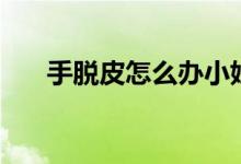 手脫皮怎么辦小妙招（手脫皮怎么辦）