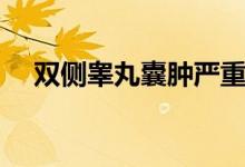 雙側(cè)睪丸囊腫嚴(yán)重嗎（睪丸囊腫嚴(yán)重嗎）