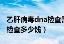 乙肝病毒dna檢查需要多少錢（乙肝病毒dna檢查多少錢）