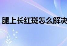 腿上長紅斑怎么解決（腿上長紅斑怎么回事）