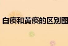 白痰和黃痰的區(qū)別圖解（白痰和黃痰的區(qū)別）