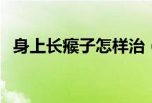 身上長(zhǎng)瘊子怎樣治（身上長(zhǎng)瘊子怎么消除）