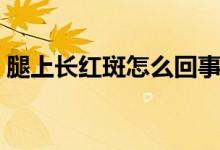 腿上長紅斑怎么回事（腿上長紅斑怎么回事）