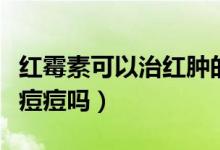 紅霉素可以治紅腫的痘痘嗎（紅霉素可以治紅痘痘嗎）
