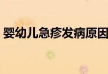 嬰幼兒急疹發(fā)病原因（嬰幼兒急疹發(fā)燒規(guī)律）