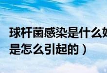 球桿菌感染是什么婦科病（婦科球菌桿菌感染是怎么引起的）