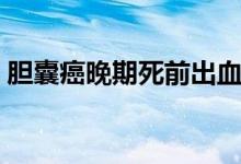 膽囊癌晚期死前出血（膽囊癌晚期死前征兆）