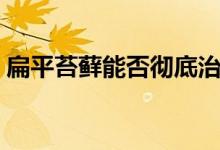 扁平苔蘚能否徹底治愈（扁平苔蘚能自愈嗎）