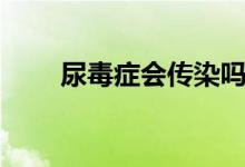 尿毒癥會(huì)傳染嗎（尿毒癥會(huì)傳染嗎）