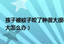 孩子被蚊子咬了腫很大很硬用什么藥（孩子被蚊子咬了腫很大怎么辦）