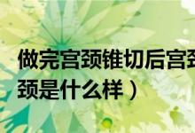 做完宮頸錐切后宮頸的樣子（錐切后好了的宮頸是什么樣）