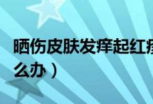 曬傷皮膚發(fā)癢起紅疹怎么辦（曬傷皮膚發(fā)癢怎么辦）