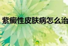 紫癜性皮膚病怎么治（紫癜性皮膚病什么樣）