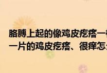 胳膊上起的像雞皮疙瘩一樣還癢怎么回事（胳膊上起了一片一片的雞皮疙瘩、很癢怎么回事）