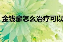 金錢癬怎么治療可以除根（金錢癬怎么治療）