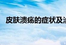 皮膚潰瘍的癥狀及治療（皮膚潰瘍的癥狀）