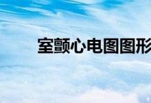 室顫心電圖圖形（室顫心電圖特點(diǎn)）