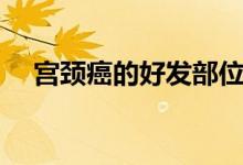 宮頸癌的好發(fā)部位（宮頸癌的好發(fā)部位）