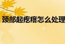 頸部起疙瘩怎么處理（頸部起疙瘩怎么回事）