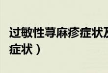 過敏性蕁麻疹癥狀及治療方法（過敏性蕁麻疹癥狀）