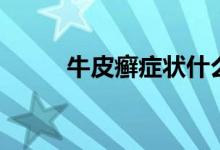 牛皮癬癥狀什么樣（牛皮癬癥狀）