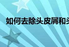 如何去除頭皮屑和頭癬（如何去除頭皮屑）