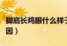 腳底長(zhǎng)雞眼什么樣子圖解（腳底長(zhǎng)雞眼什么原因）