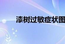 漆樹過敏癥狀圖片（漆樹過敏癥狀）