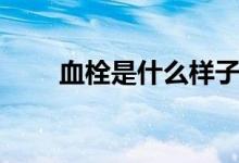 血栓是什么樣子圖片（血栓是什么）