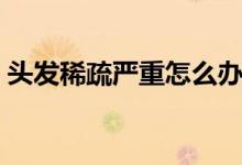 頭發(fā)稀疏嚴重怎么辦（頭發(fā)稀疏怎么辦最好）