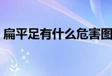 扁平足有什么危害圖片（扁平足有什么危害）