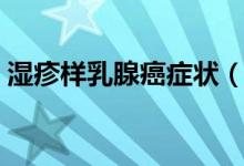 濕疹樣乳腺癌癥狀（濕疹樣乳癌早期的癥狀）