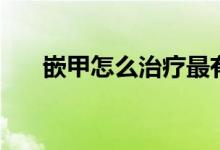 嵌甲怎么治療最有效（嵌甲怎么治療）