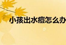 小孩出水痘怎么辦（小孩出水痘怎么辦）