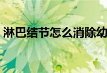 淋巴結(jié)節(jié)怎么消除幼兒（淋巴結(jié)節(jié)怎么消除）