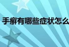 手癬有哪些癥狀怎么治療（手癬有哪些癥狀）