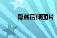 骨盆后傾圖片（骨盆后傾怎么辦）