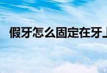 假牙怎么固定在牙上（假牙的種類及價格）