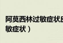 阿莫西林過敏癥狀皮疹如何止癢（阿莫西林過敏癥狀）