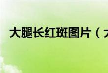 大腿長紅斑圖片（大腿內(nèi)側(cè)紅斑是梅毒嗎）